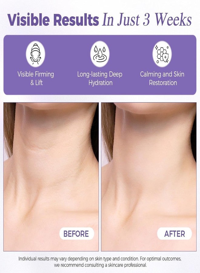 OUKEYA Retinol Lifting Neck & Face Cream for Wrinkles, Anti-Aging Peptide Neck Firming Cream with Hyaluronic Acid & Plant Extracts, Deep Hydration & Skin Brightening - Image 5